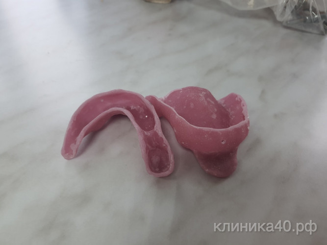 Snyat-slepok-s-zubov